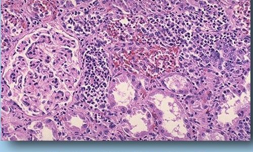 孕妇用血糖仪网 - 为你提供孕妇用血糖仪测血糖准吗、孕妇用血糖仪测血糖标准是